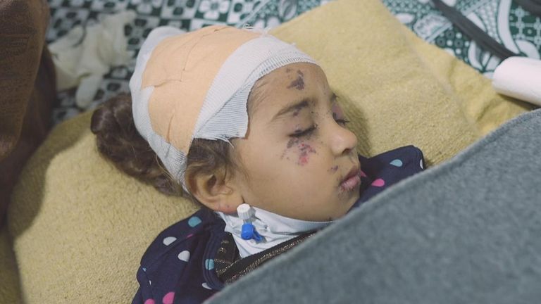 Twenty-five of Jenin's relatives were killed, including her father and all of her brothers and sisters, in an Israeli strike that left her badly hospitalised.
